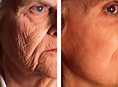 Plastic surgery (cosmetic surgery) before and after photograph